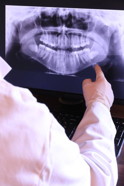Best Emergency Tooth Extraction in Dublin, GA